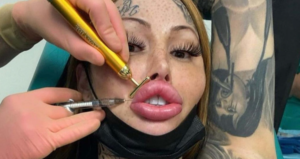 surgery
